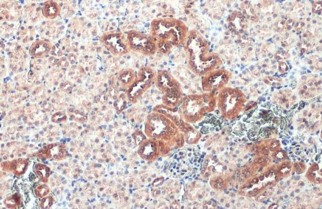 Anti-Caspase 1