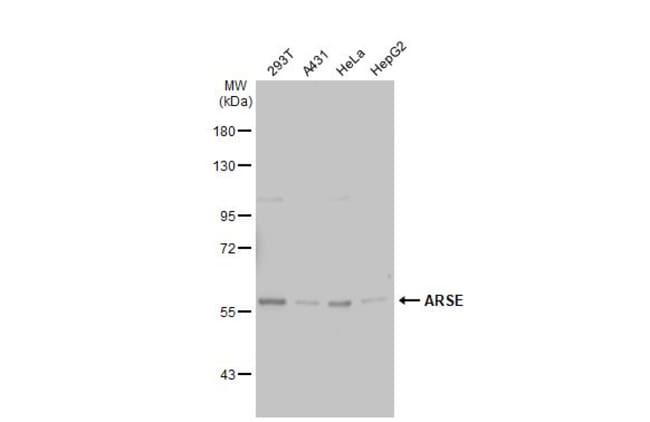 Anti-ASE