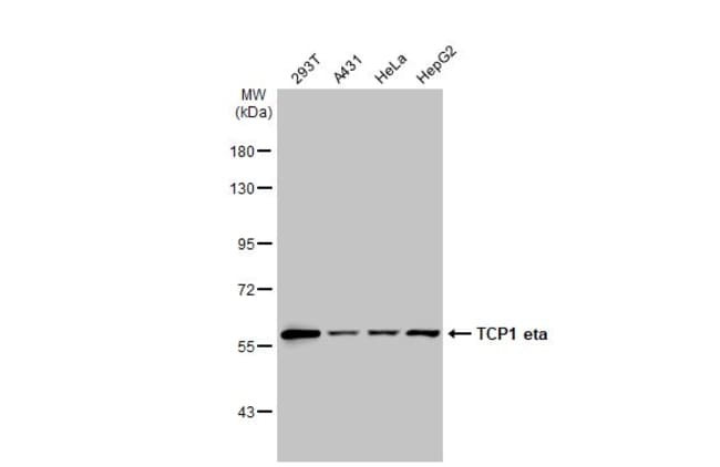 Anti-TCP1 eta