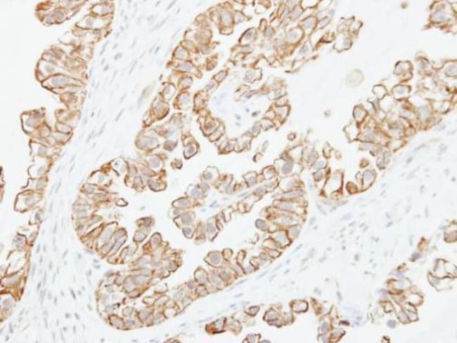 Anti-Adenylate cyclase 2