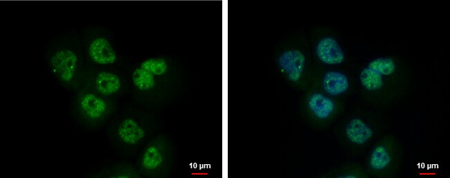 Anti-Adenosine kinase
