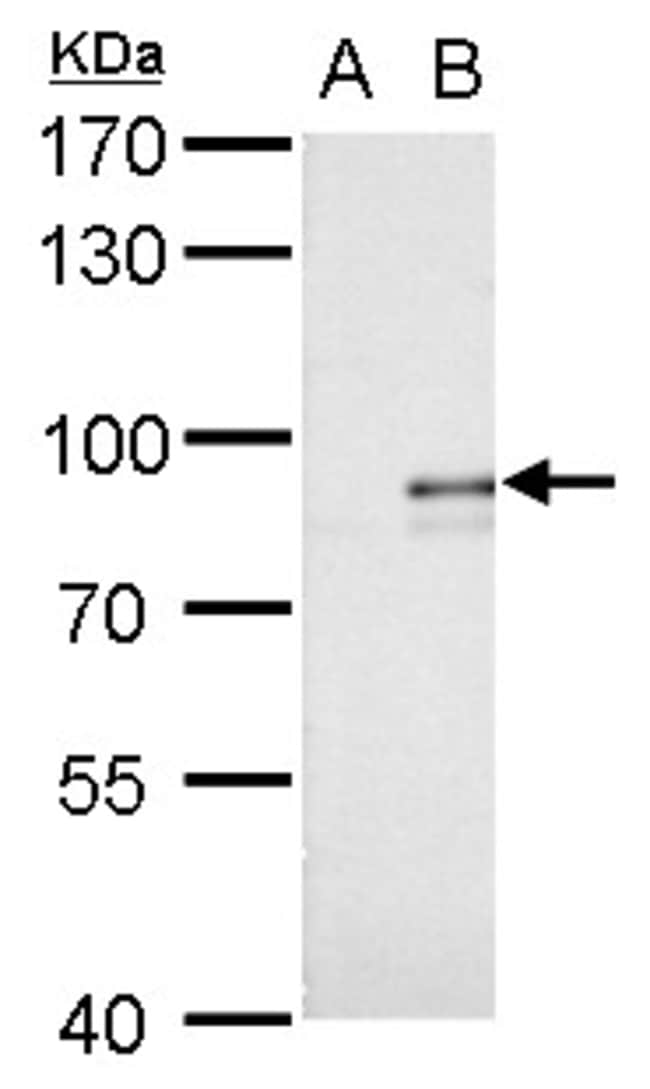 Anti-Alkyl-DHAP synthase