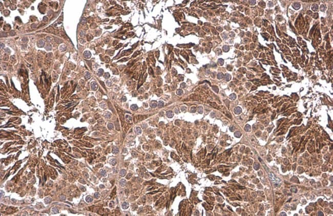 Antibody, PGK1, anti phosphoglycerate ki
