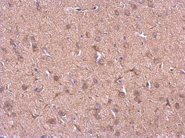 Anti-HSP90 beta