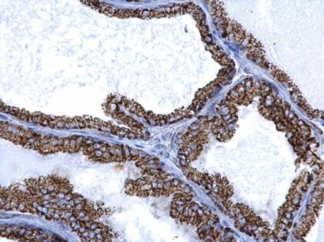 Anti-ALDH2