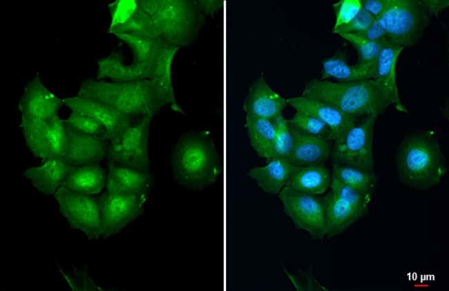 Anti-Casein Kinase 2 beta