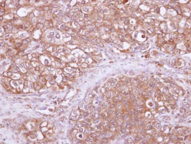 Anti-ARHGAP1