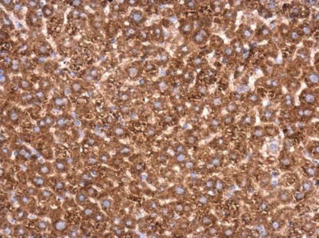 Anti-Transketolase