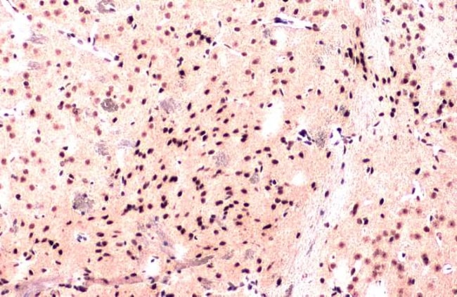 Anti-hnRNP 1