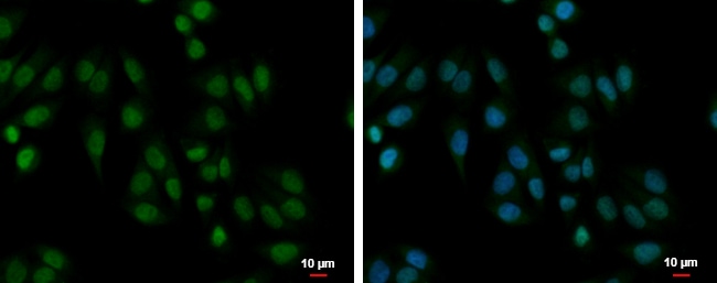 Anti-PABPN1
