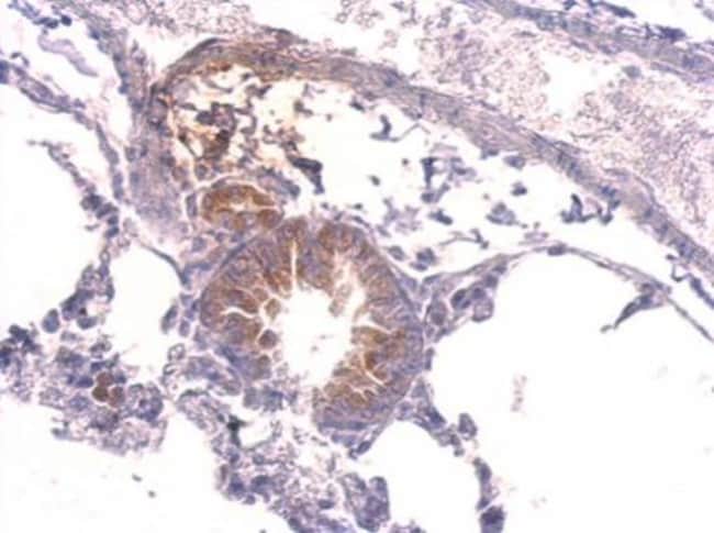Anti-Tyrosyl tRNA synthetase