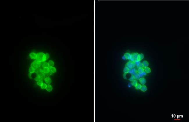 Anti-CD19