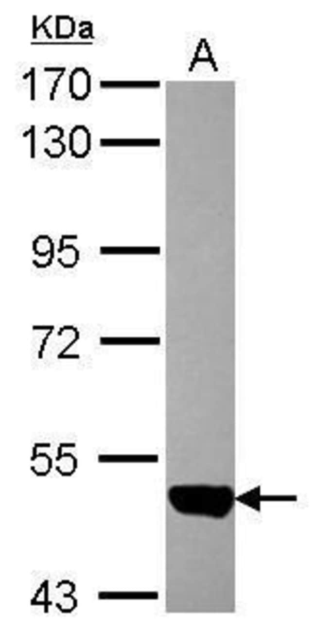 ANTI-ACTIVIN A RECEPTOR TYPE II-LIKE 1