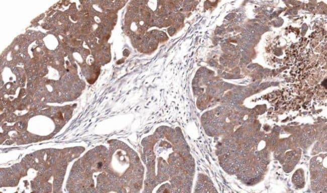 Anti-Cytidine deaminase