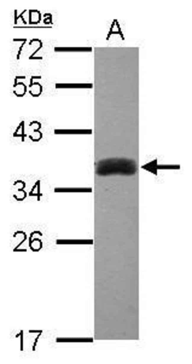 Anti-SULT1A3