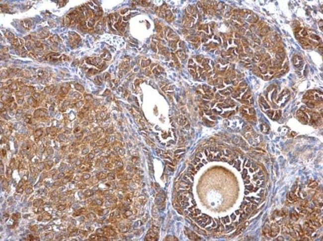 Anti-Septin 2