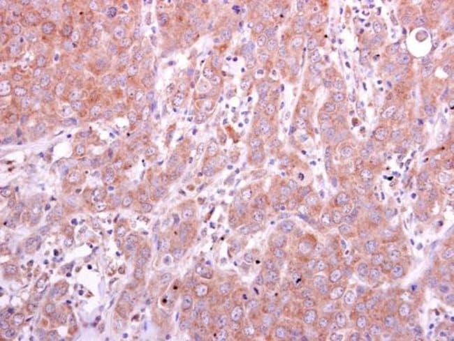 Anti-PGD