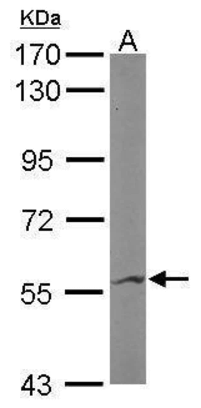 Anti-IMPDH2