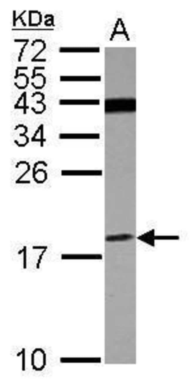 Anti-V-ATPase F