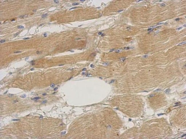 Anti-Septin 2