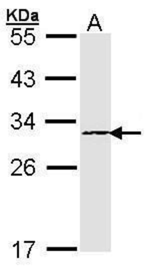 Anti-Proteasome beta 4