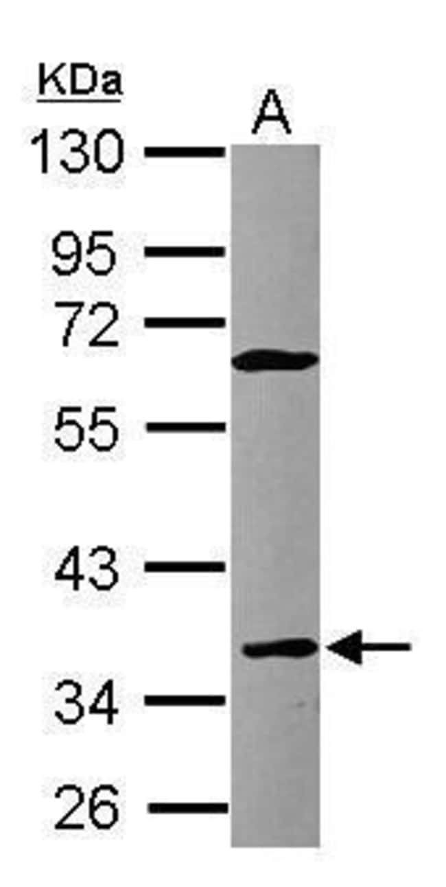 Anti-CD23