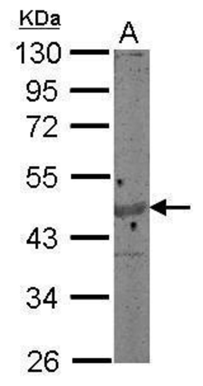 Anti-gamma Actin