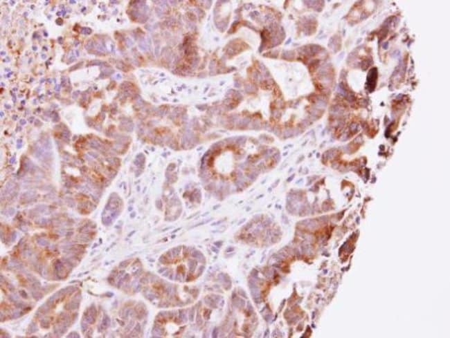 Anti-Guanylate kinase