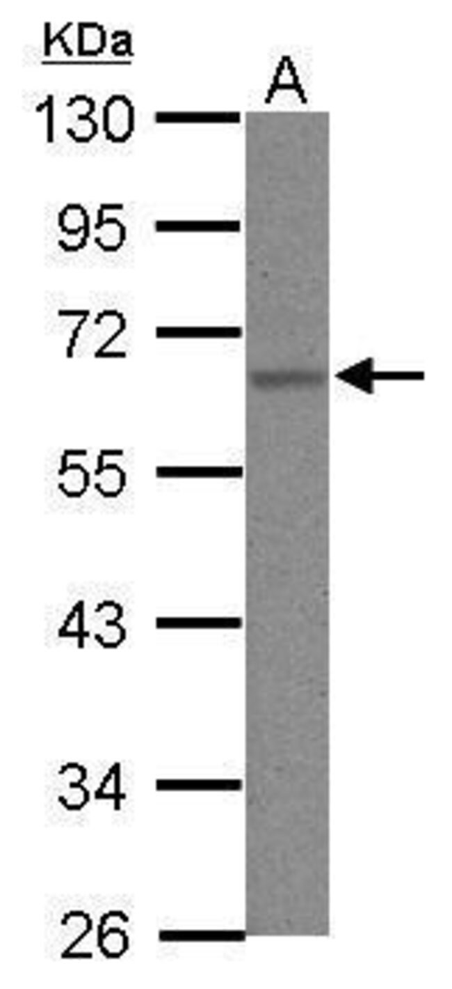 Anti-hnRNP K