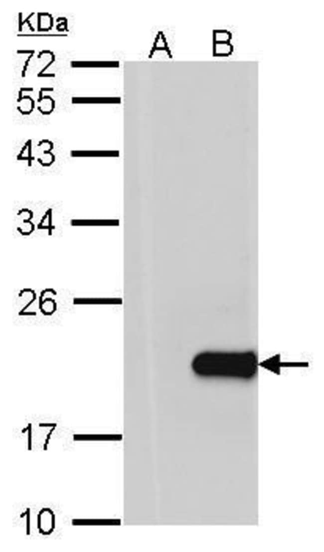 Anti-HPCAL1
