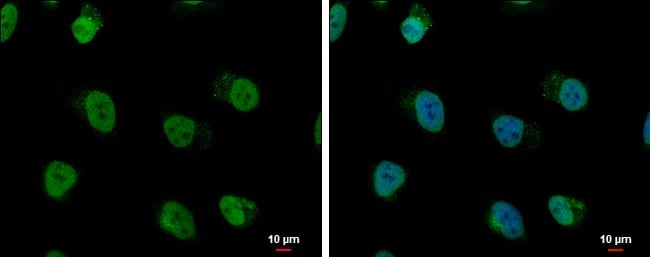 Anti-hnRNP A/B
