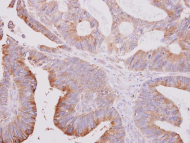 Anti-beta Tubulin 2
