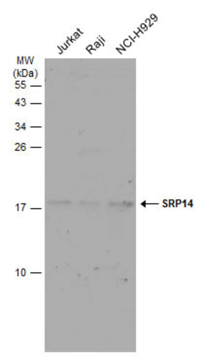 Anti-SRP14