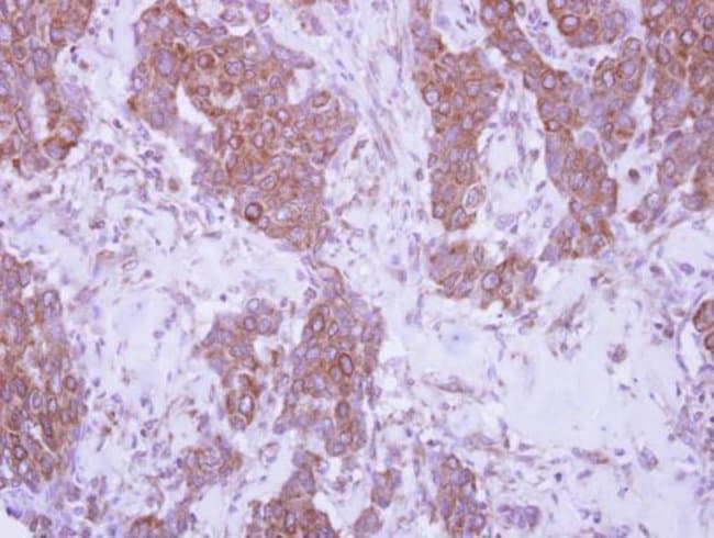 Anti-CD79b
