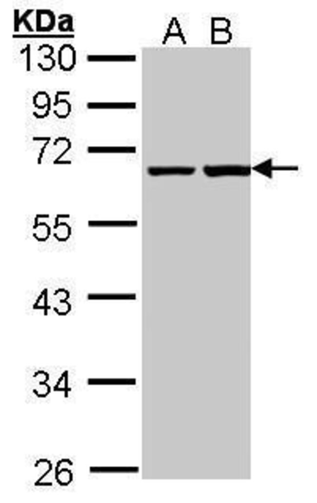 Anti-PHF1