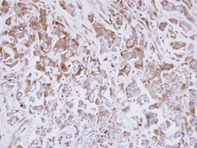Anti-Exostosin-like 3