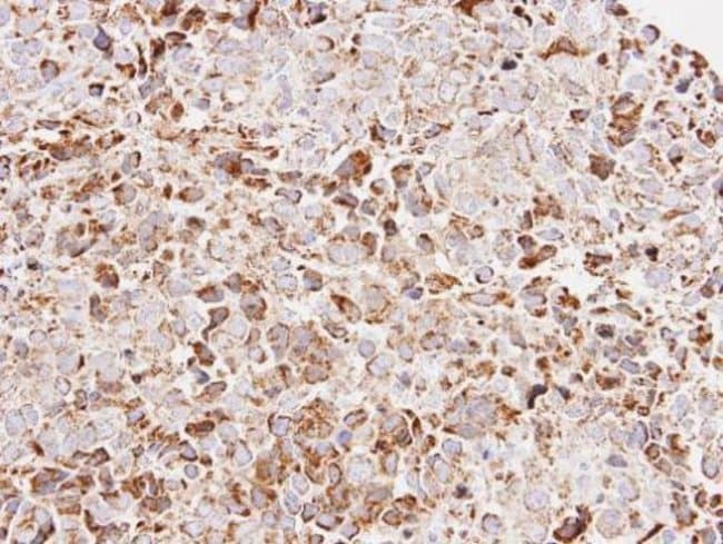 Anti-ATP synthase O