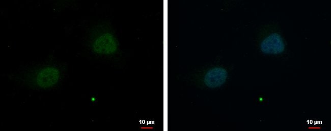Anti-ZNF384
