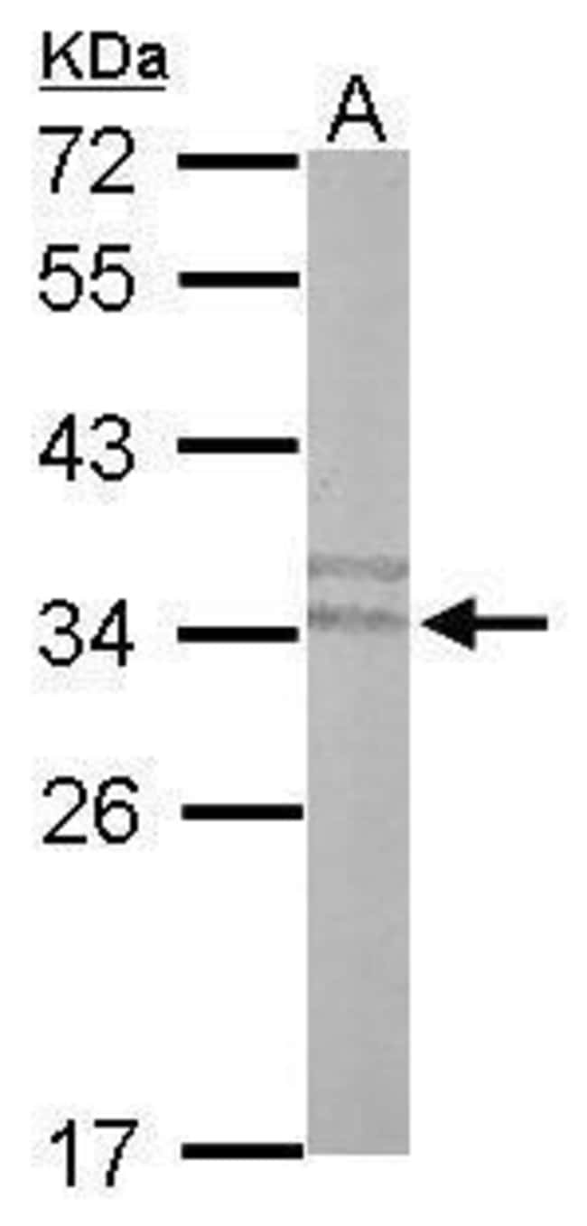 Anti-PLSCR3