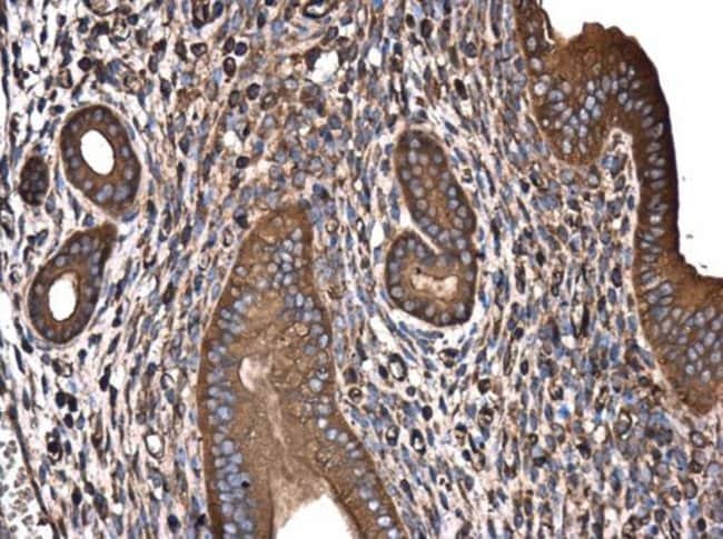 Anti-GABARAPL2