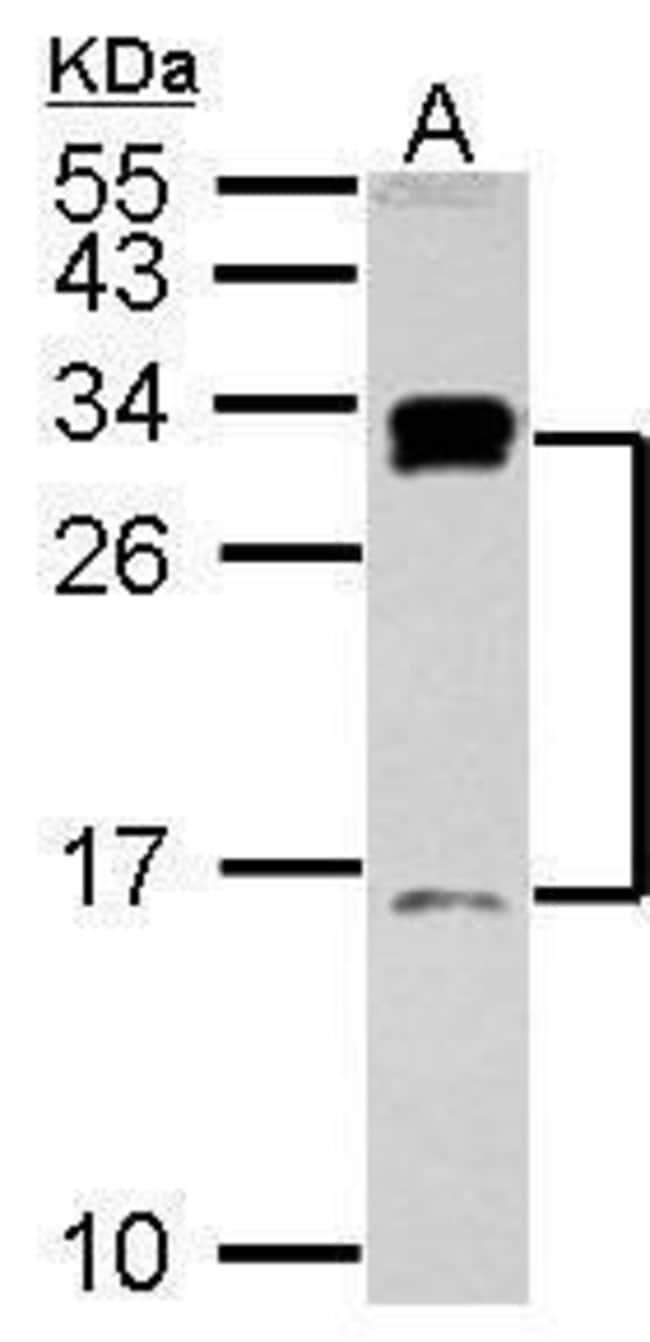 Anti-C1D