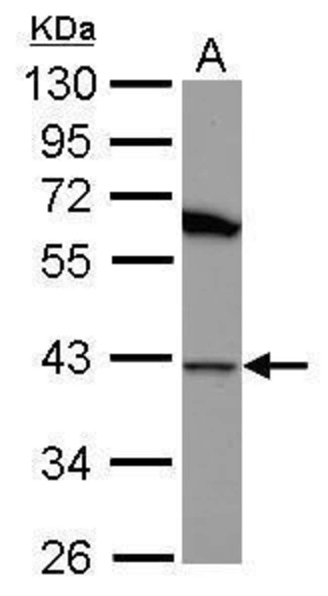 Anti-Hsp40