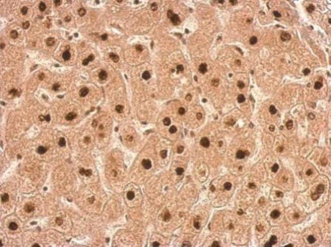 Anti-Transaldolase