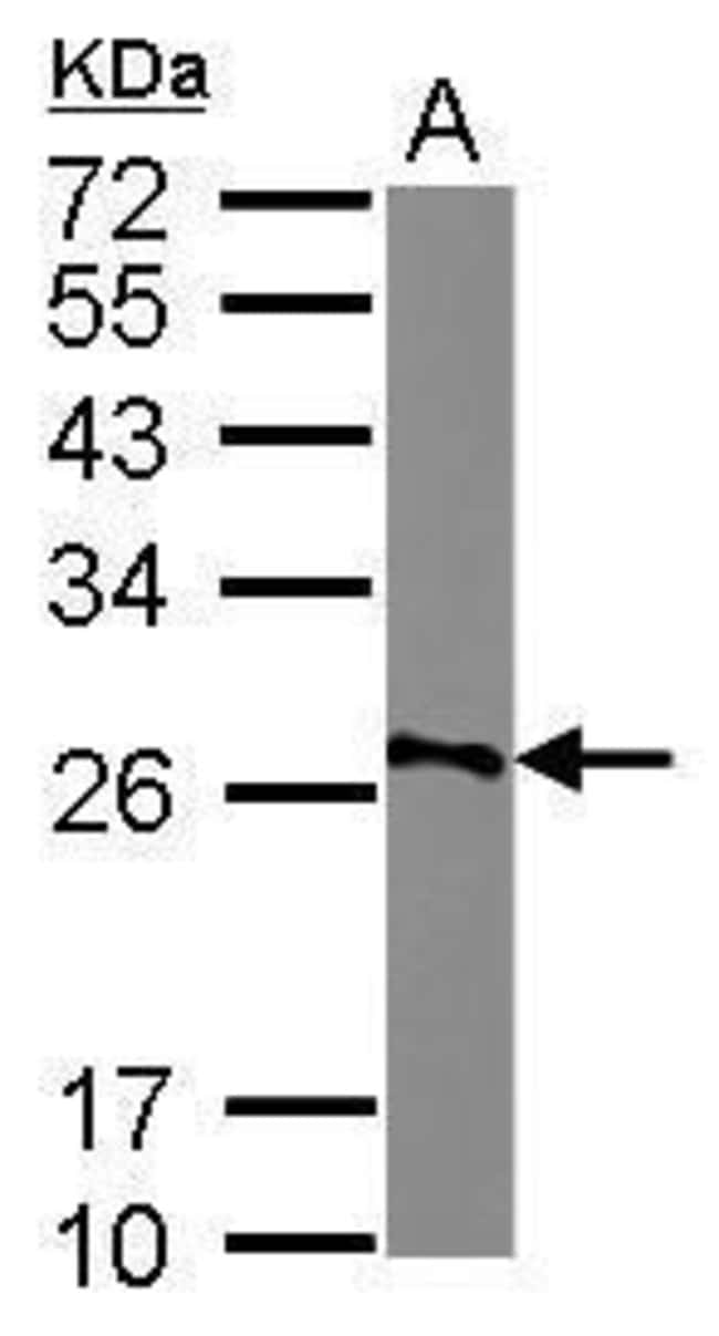 Anti-AGPAT1