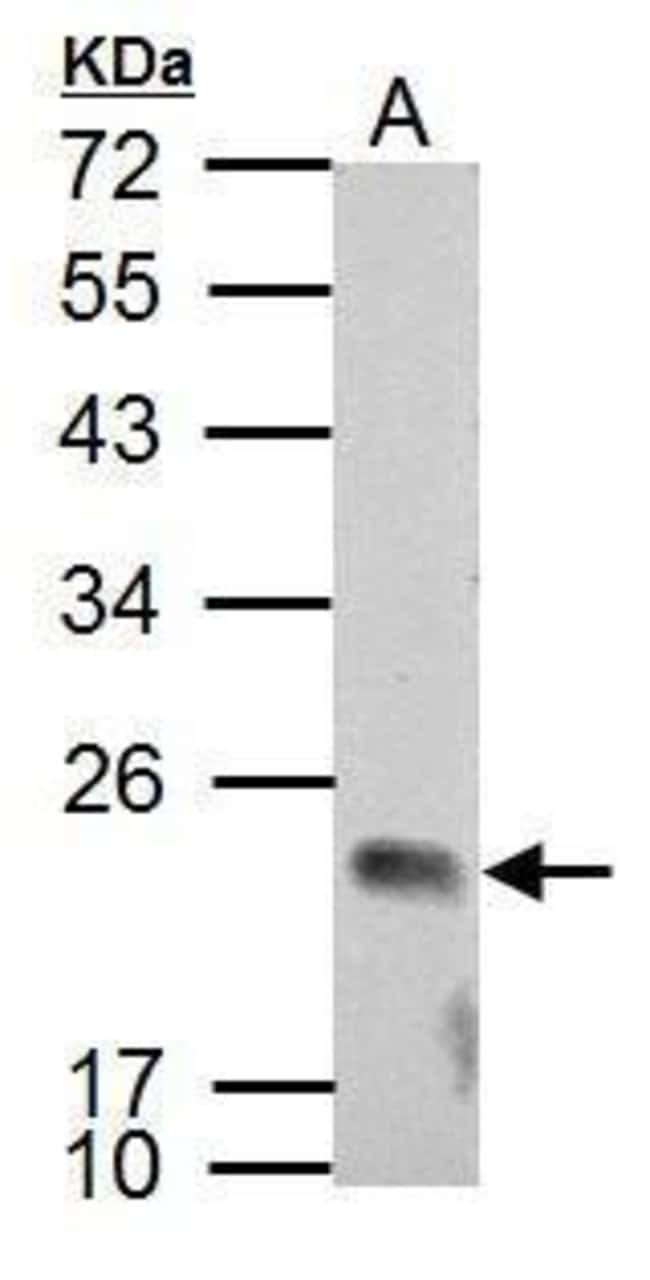 Anti-APOBEC3C