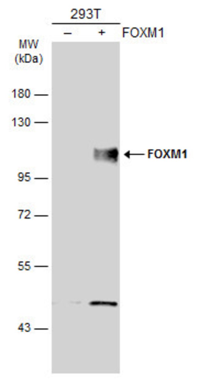 Anti-FOXM1