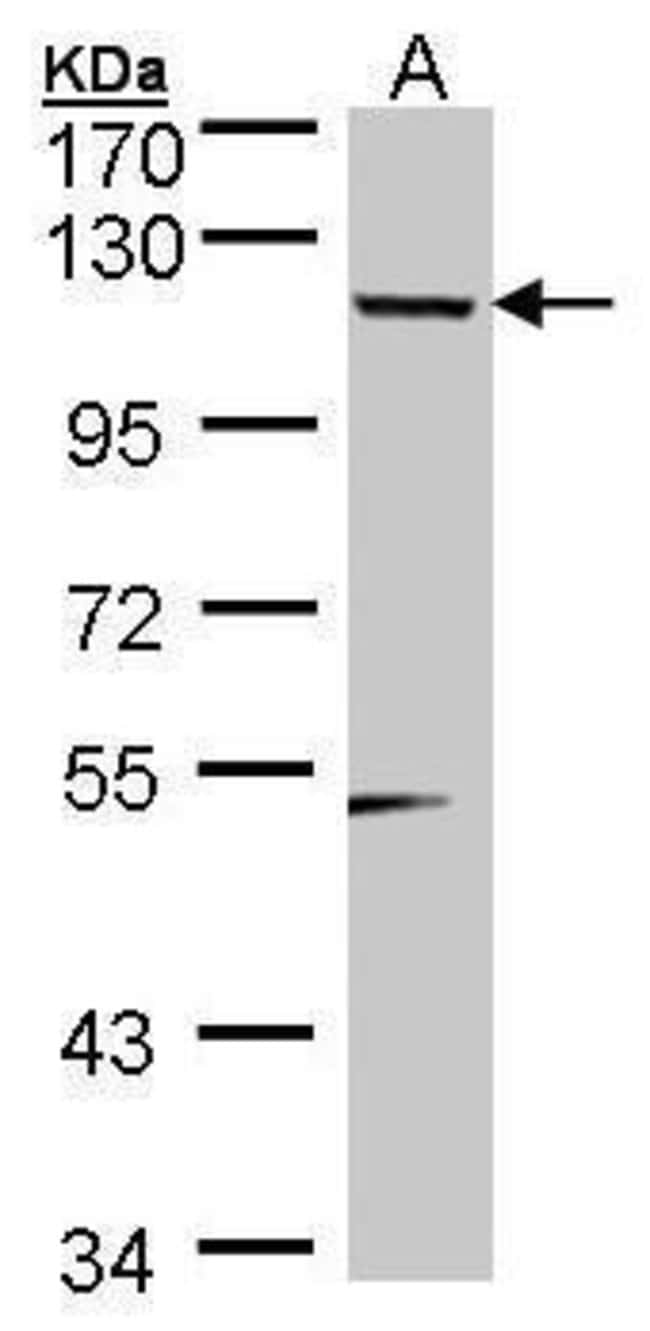 Anti-SDCCAG33