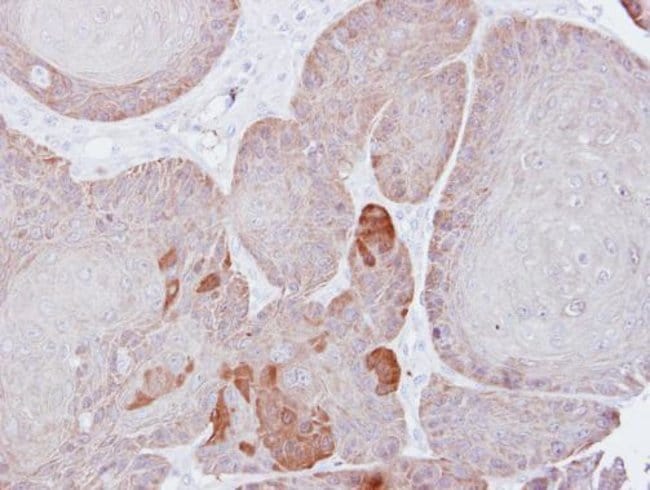 Anti-Proteasome 26S S3