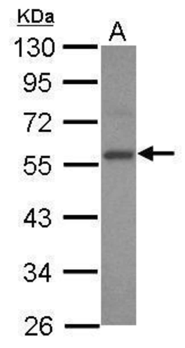 Anti-E2F3