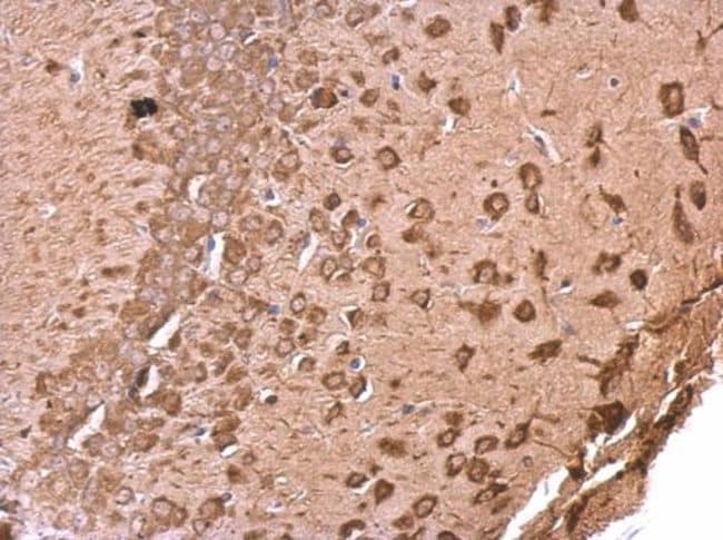 Anti-EEF1A2